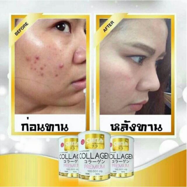 collagen-ผง-บำรุงผิว-เพื่อผิวสุขภาพดี-ขาวกระจ่างใส-chita-premium-ชิตะ-คอลลาเจน-แท้-100