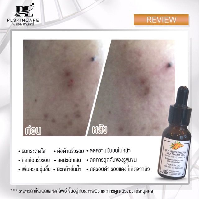 ออแกนิคออยล์-sea-buckthorn-organic-treatment-oil-ของแท้รหัสตัวแทน-pl-platinum13