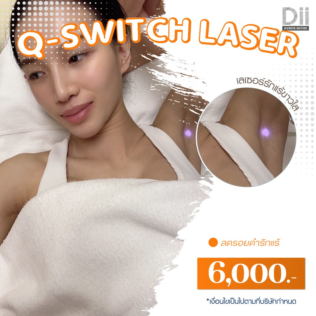 ภาพหน้าปกสินค้าDii Aesthetic : Q-switch Laser 1Time (รักแร้) จากร้าน dii_aesthetic บน Shopee