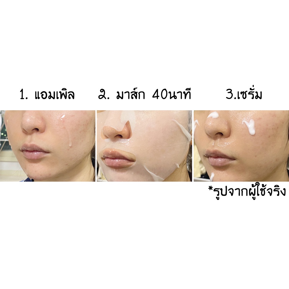 มาส์กหน้า3สเตป-kcmi-1กล่อง-มี5แพ็ค-นำเข้าจากเกาหลี-ส่งฟรี-ขายส่ง-kcmi-sheet-mask