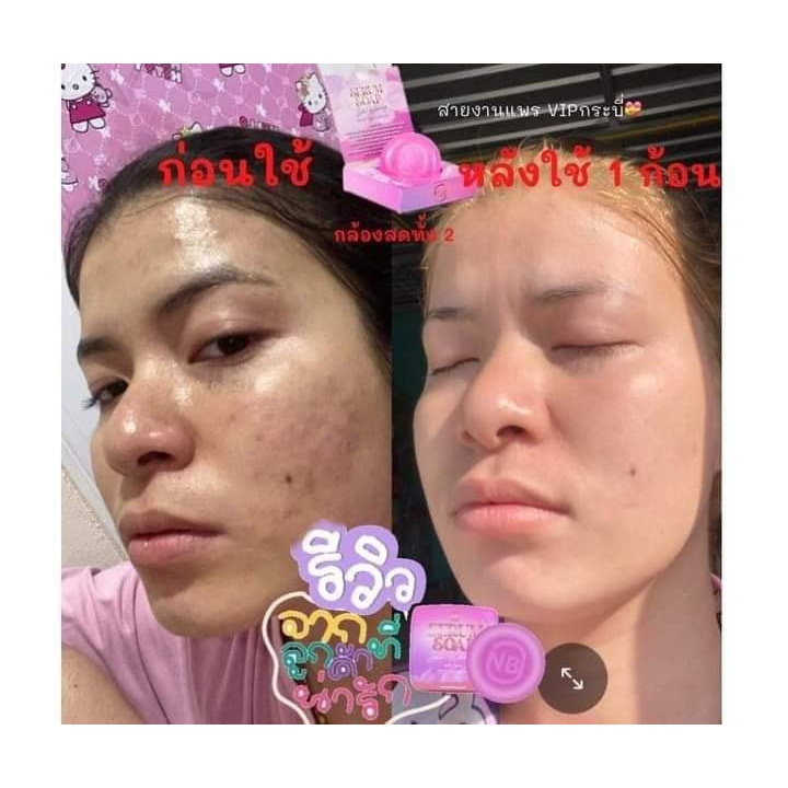 สบู่เซรั่มnb-สบู่nb-สบู่เนเงินครูเบียร์-สบู่ครูเบียร์
