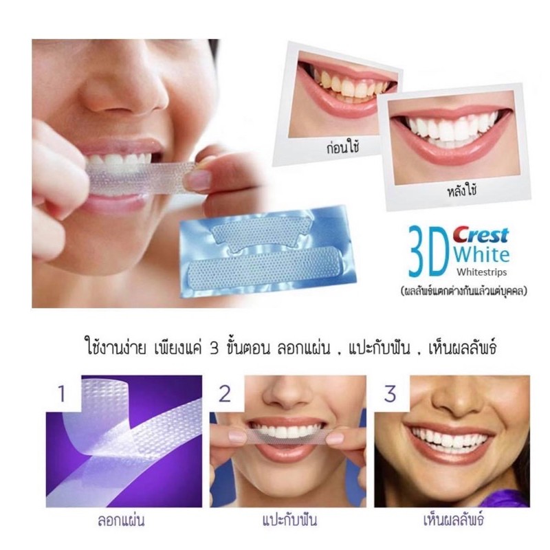 exp-12-24-crest-3dwhite-whitestrips-professional-effects-แผ่นฟอกฟัน