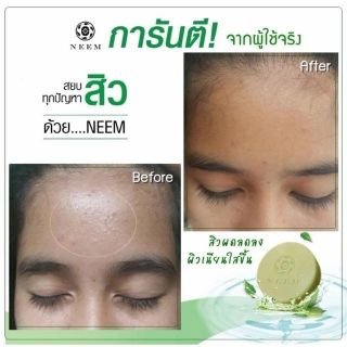 NEEM Bright & Clear Acne Soap 50g.  สบู่นีม สบู่สิวหลุด บอกลาหน้าสิว สู่หน้าใส