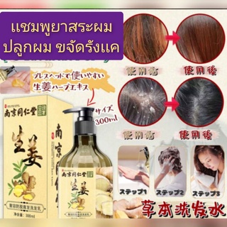 แชมพูบำรุงหนังศรีษะปลูกเส้นผมScalp nourishing shampoo hairแชมพูบำรุงหนังศรีษะปลูกเส้นผม ลดปัญหาผมร่วง