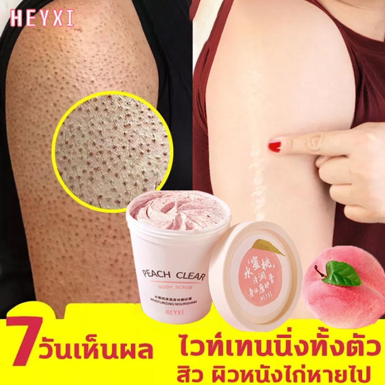 สครับขัดผิวขาว-200g-สครับขัดผิวขาว-ขัดขี้ไคล-สครับผิวกาย-เอกซ์โฟลิเอทติ้ง-สครับผิวขาวไว-ช่วยผิวขาว-นุ่ม-เนียนกระจ่างใส