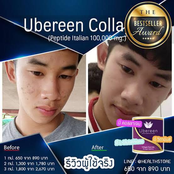 ubereen2-คอลลาเจนที่มีส่วนผสมวิตามินซีกลูต้า-คอลลาเจนเกรดpremuimมาตรฐานยุโรป-ผิวสวยสุขภาพดี-ร้านของบริษัทโดยตรง