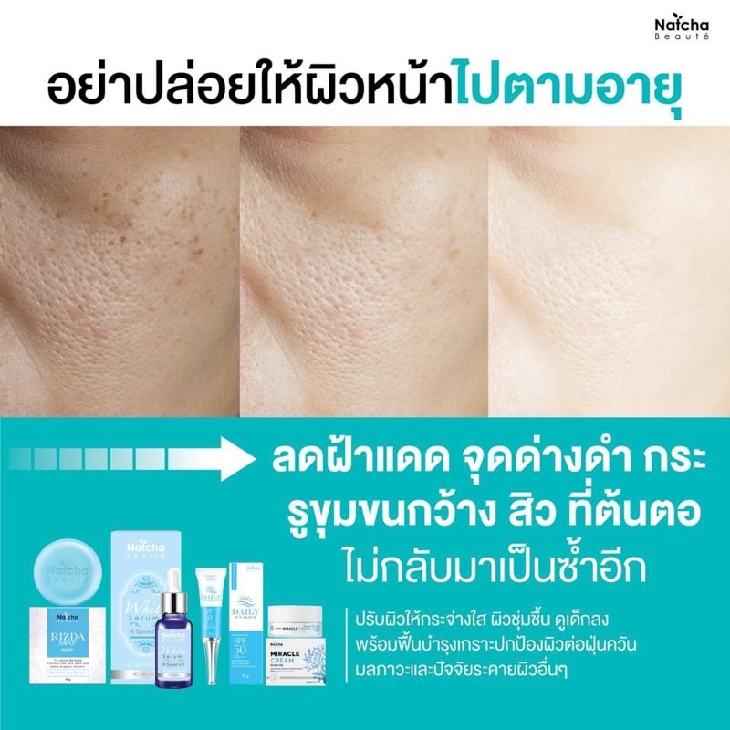 โปรโมชั่น-ยกset-ซื้อ-10-แถม-2-เซรั่มณัชชา-30-กรัม-6-ขวด-คลีมณัชชา-18-กรัม-6-กระปุก