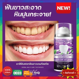 ยาสีฟัน Dental switz ❗ 1 แถม 1 ส่งฟรี ❗เจลฟอกฟันขาว ยาสีฟันฟอกฟันขาว กลิ่น ปาก หินปูน ฟอกฟันเองที่บ้าน แบบมีราง