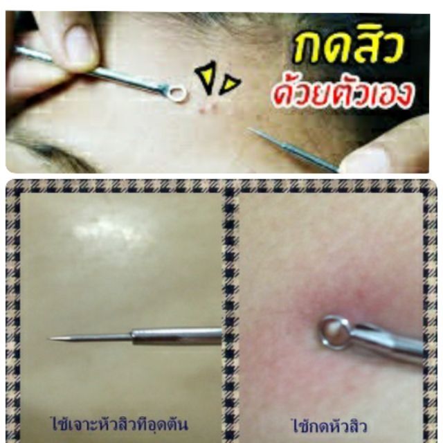 ที่กดสิว-ที่เจาะหัวสิว-มี-2-ด้านค่ะ