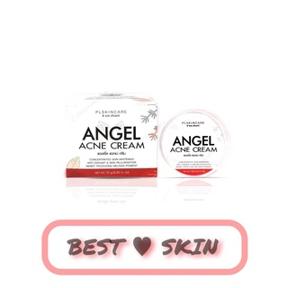 Angel Acne Cream by PL แองเจิ้ล แอคเน่ ครีมลดสิว [10 g.]