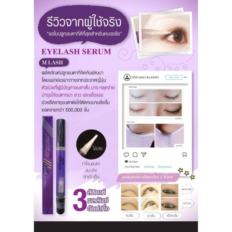 mw-lash-eyelash-serum-เซรั่มบำรุงขนตาปลูกขนตาขนคิ้วเห็นผลใน-2สัปดาห์มี-อย-คิดค้นโดยนายแพทย์ผู้เชี่ยวชาญด้านขนตาจากญีปุ่น