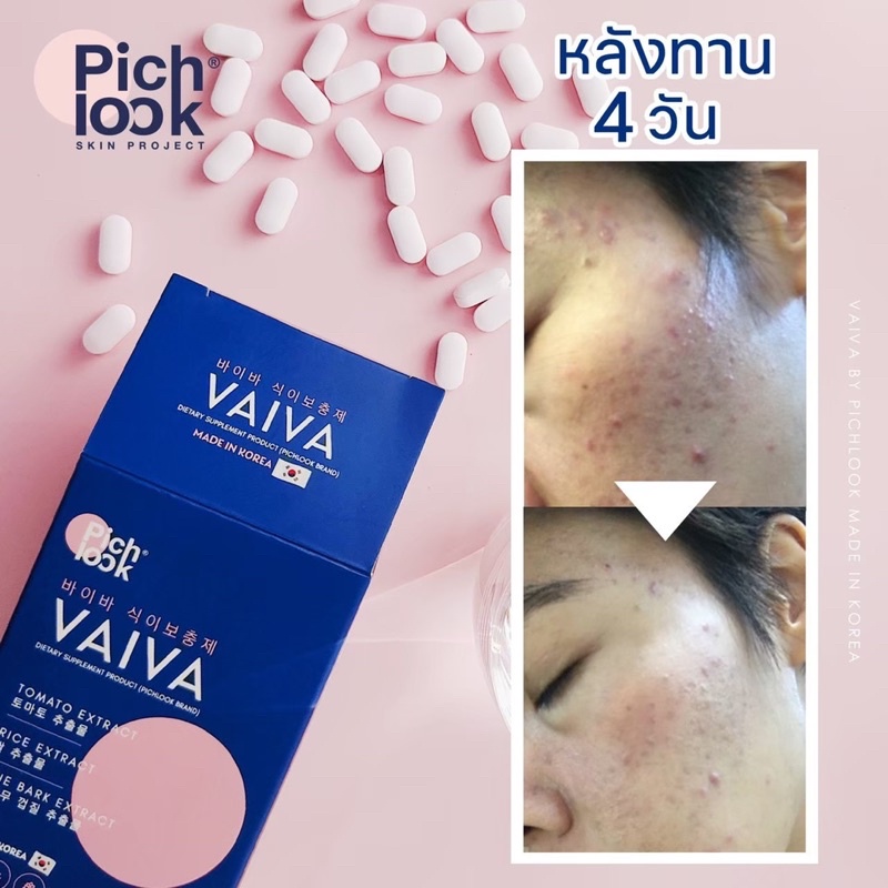 vaiva-by-pichlook-ผิวขาวใสออร่า