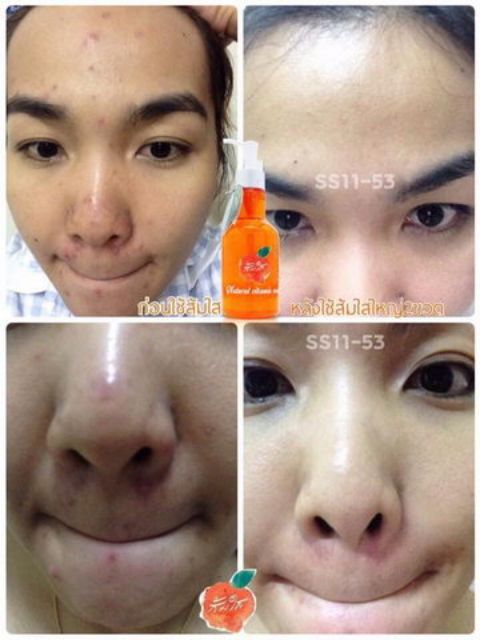 ของแท้-พร้อมส่ง-somsai-ส้มใสบำรุงผิวหน้าให้ขาวใส-ขจัดความมันส่วนเกิน-ลดรอยหมองคล้ำ-เหมาะสำหรับทุกสภาพผิว