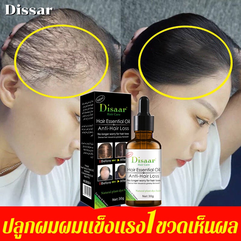 disaar-เซรั่มปลูกผม-น้ำยาปลูกผม-ฟื้นฟูผม-ป้องกันผมร่วง-เซรั่มบำรุงผม-เร่งผมขึ้นใหม่-รักษาผม-ลดผมร่วง-หยุดผมร่วง-รักษาผมร