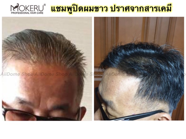 mokeru-1แถม1-แชมพูปิดผมหงอก-แชมพูย้อมผมดำ-ด้วยสารสกัดสมุนไพร