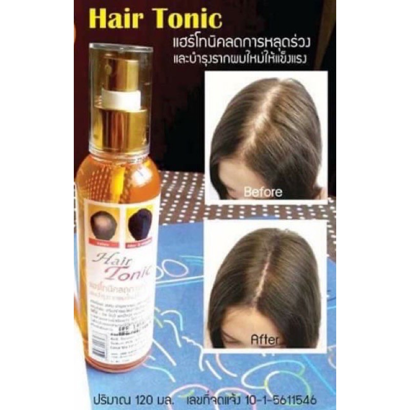ภาพสินค้าGenive Tonic Hair Spray 120 ml จีนิวี แฮร์โทนิค ลดผมร่วง ปลูกผม เร่งผมยาว จากร้าน hairbeauty_online บน Shopee ภาพที่ 3