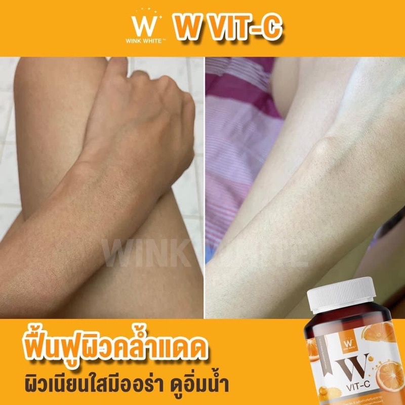 วิตามินซี-แบรนด์วิ้งไวท์-โปร-5-แถม-6-ส่งฟรี