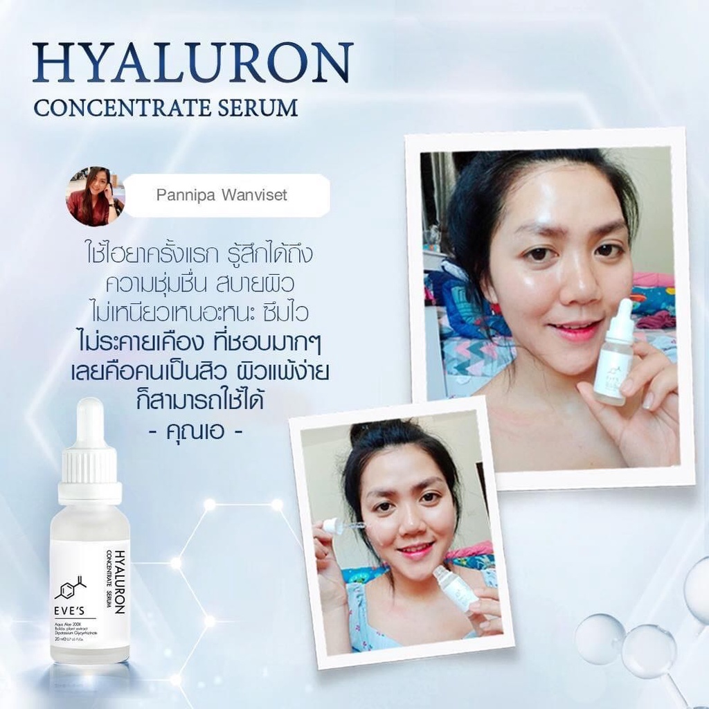 hyaluron-ไฮยาอีฟส์-ผิวฟู-เด้งเหมือนสาวเกาหลี