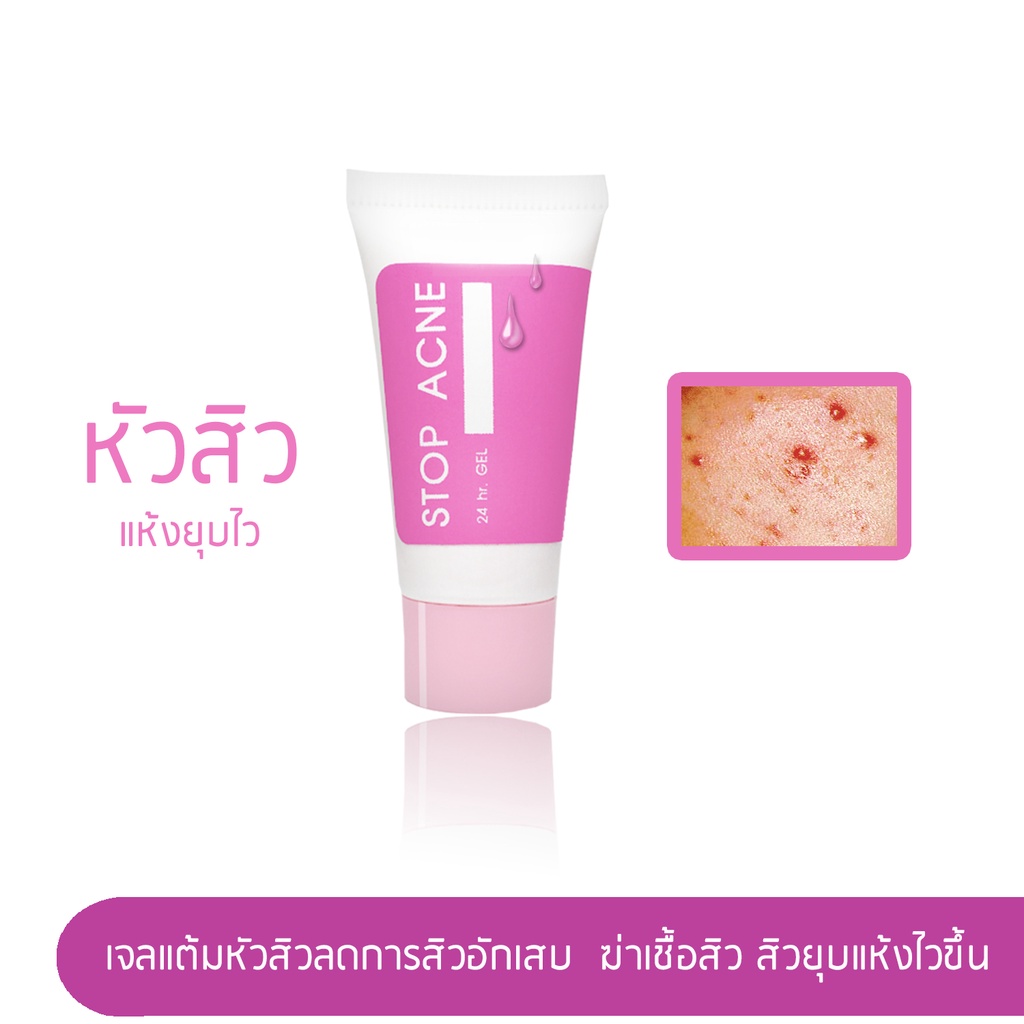 stop-acne-gel-10-g-l-เจลแต้มหัวสิว-ลดการอักเสบ-ฆ่าเชื้อสิว-ให้หัวสิวยุบแห้งไวขึ้น