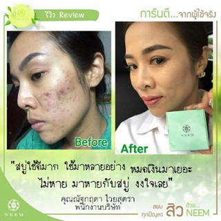 Neem Bright & Clear Acne Soap สบู่ออร์แกนิค สบู่นีม สบู่รักษาสิว สบู่สิวหลุด neem natural