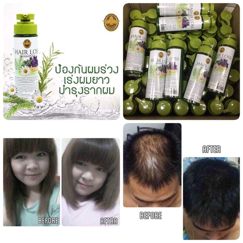 1แถม1-ส่งฟรีแชมพู-แฮร์ลอส-แชมพูสำหรับผมร่วงและช่วยเร่งผมยาว