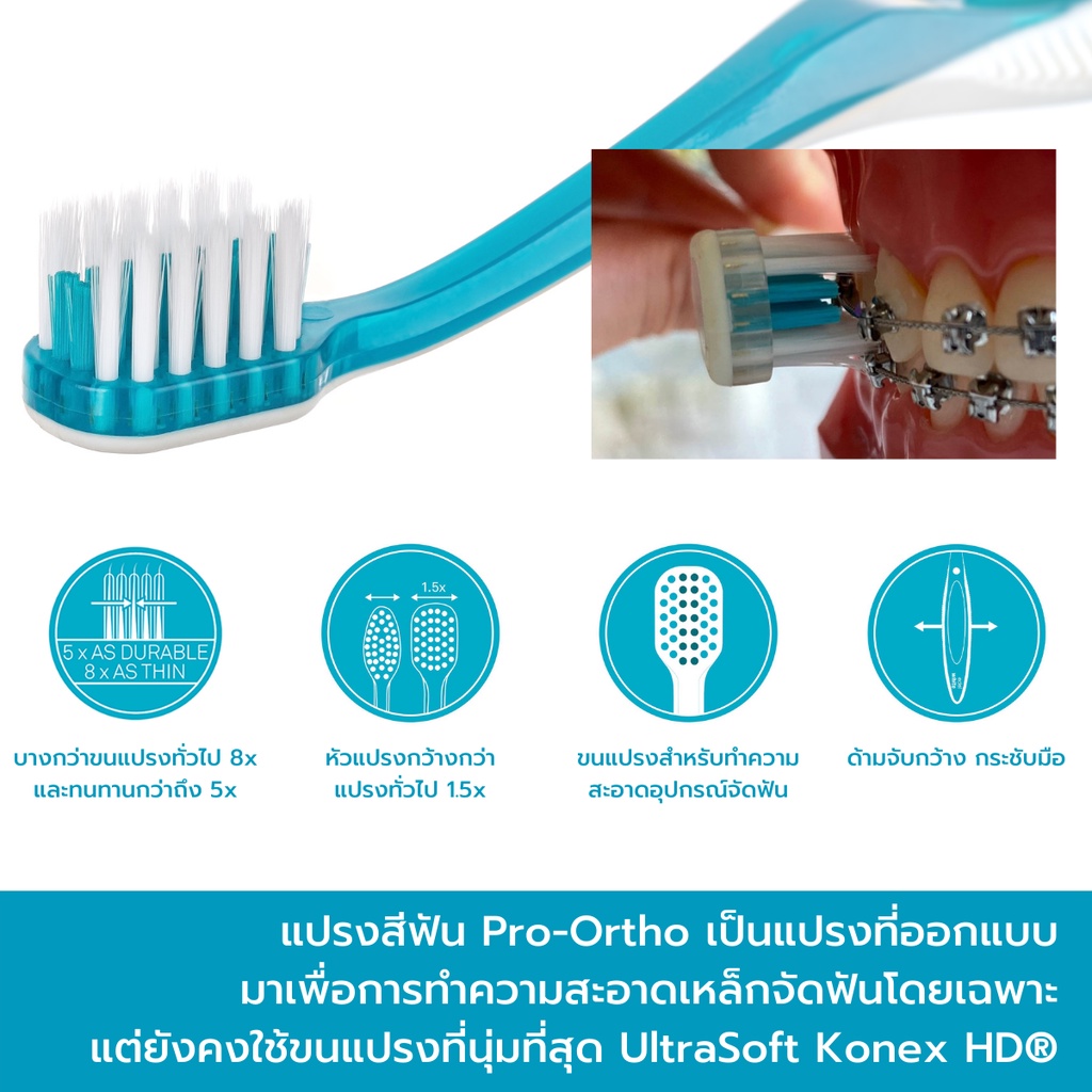 สำหรับคนจัดฟัน-edel-white-pro-ortho-แปรงสีฟันสำหรับคนจัดฟัน