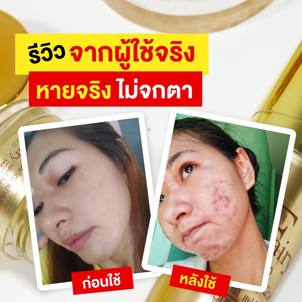 แฟร์รี่โกลด์เซรั่ม-fairy-gold-serum-ของแท้รับกับบริษัท-มีเก็บเงินปลายทาง