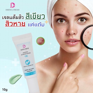 เจลแต้มหัวสิวอักเสบ อุดตัน หนอง Milacle Acness Cler Gel