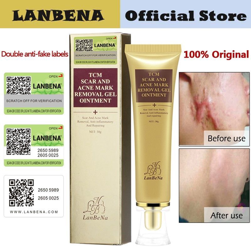 lanbena-acne-scar-removal-cream-skin-repairครีมกำจัดรอยแผลเป็นจากสิว-ครีมซ่อมแซมผิวหน้าให้ความชุ่มชื้นไวท์เทนนิ่งครีม