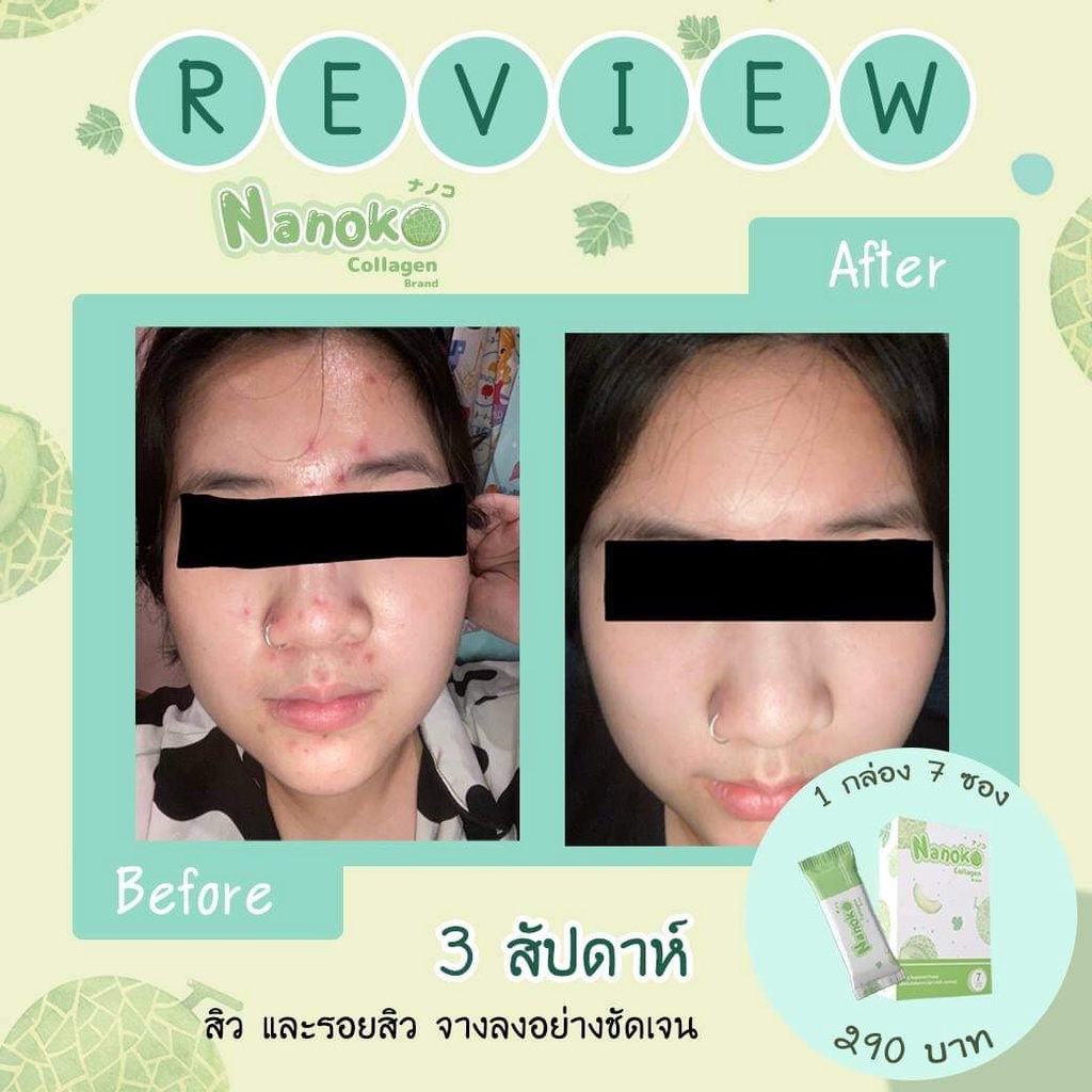 คอลลาเจนผิวใสอ่อนเยาว์ลบเลือนริ้วรอย-ป้องกันผิวจากรังสี-uva-และuvb-nanoko-collagen