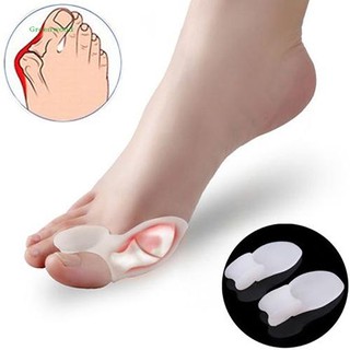 สินค้า GNWD สายรัดซิลิโคนนุ่มสวมนิ้วเท้า แยกนิ้วโป้งเท้า แก้ไขปัญหาภาวะนิ้วโป้งเก