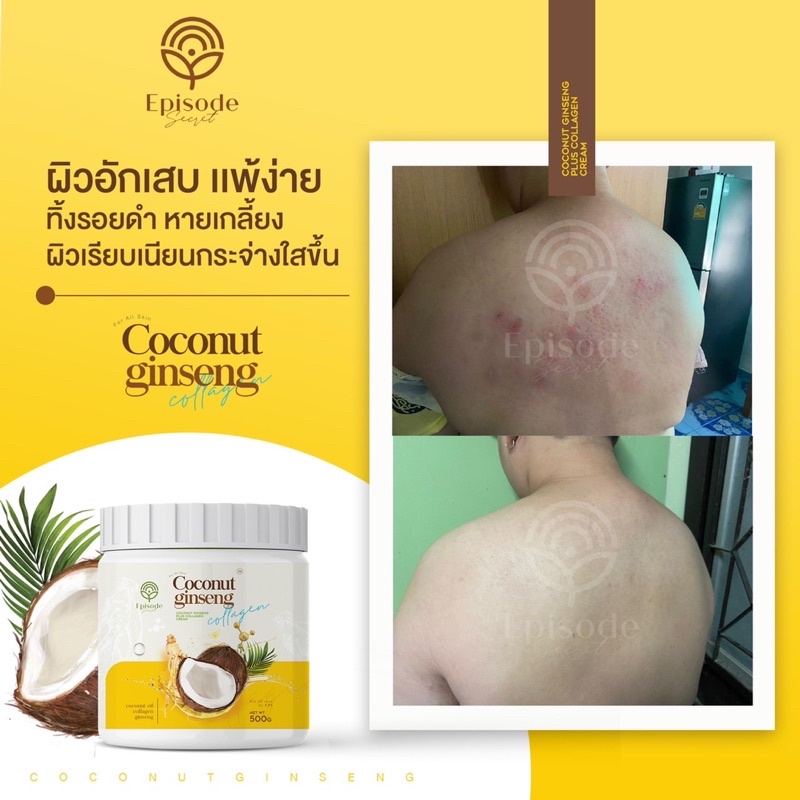 แท้100-ครีมโสมมะพร้าวโสมมะพร้าว-ใหม่โสมมะพร้าวคอลลาเจน-ครีมโสมมะพร้าว-โลชั่นโสม-โสมมะพร้าวแท้-โสมก