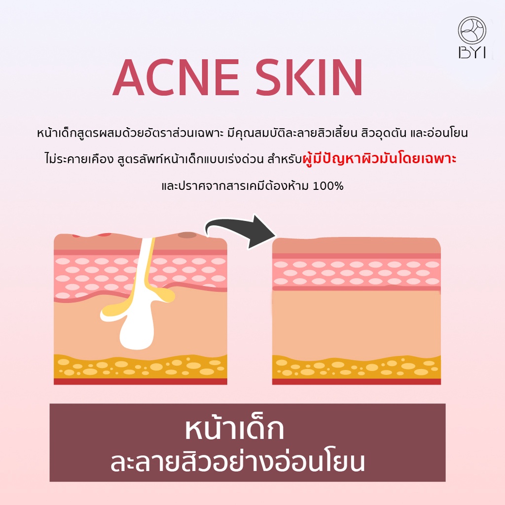 2-แถม-2-รับเลย-4-ชิ้น-เซรั่มหน้าเด็ก-young-serum-ในราคาสุดพิเศษ-เซรั่มบำรุงผิว-เซรั่มลดสิว-ysx4