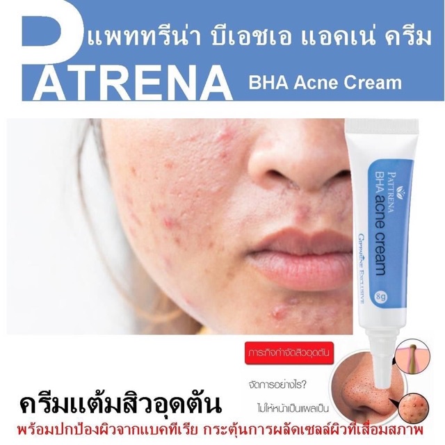 ครีมแต้มสิวอุดตัน-แพททรีน่า-บีเอชเอ-แอคเน่-ครีม-กิฟฟารีน-pattrena-bha-acne-cream-giffarine