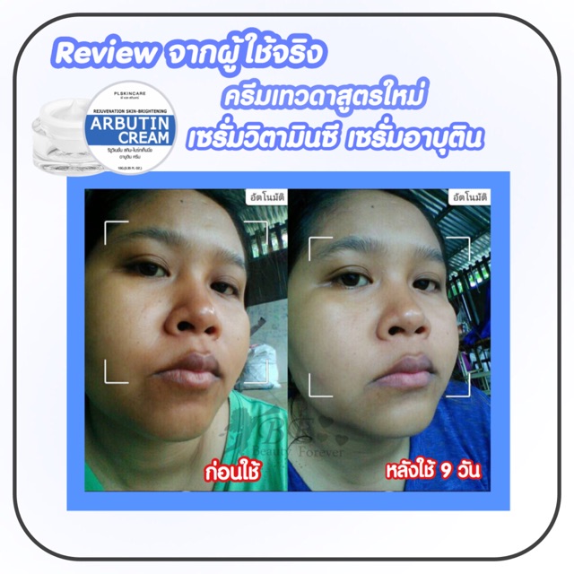 ครีมเทวดา-อาบูตินครีม-arbutin-cream-ของแท้รหัสตัวแทน-pl-platinum-13