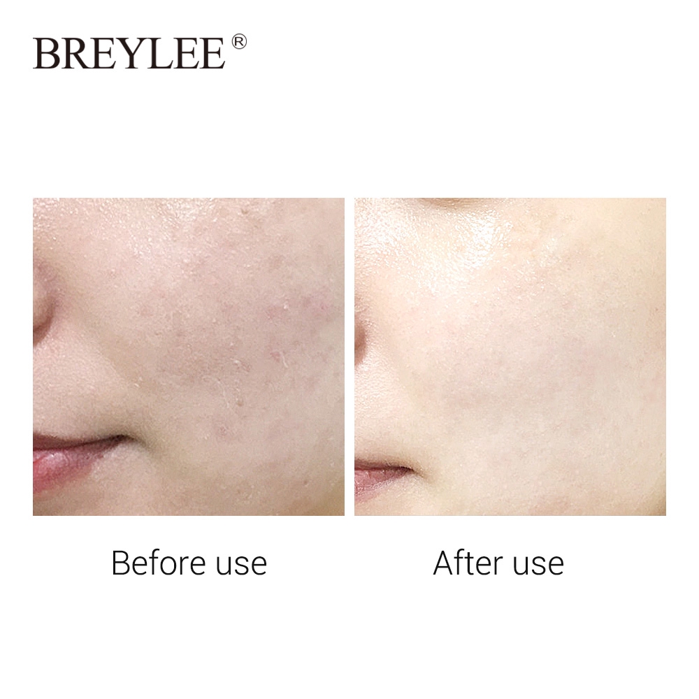 breylee-hyaluronic-acid-มาสก์เซรั่มบํารุงผิวหน้า-ให้ความชุ่มชื้นและลดริ้วรอย-1-ชิ้น