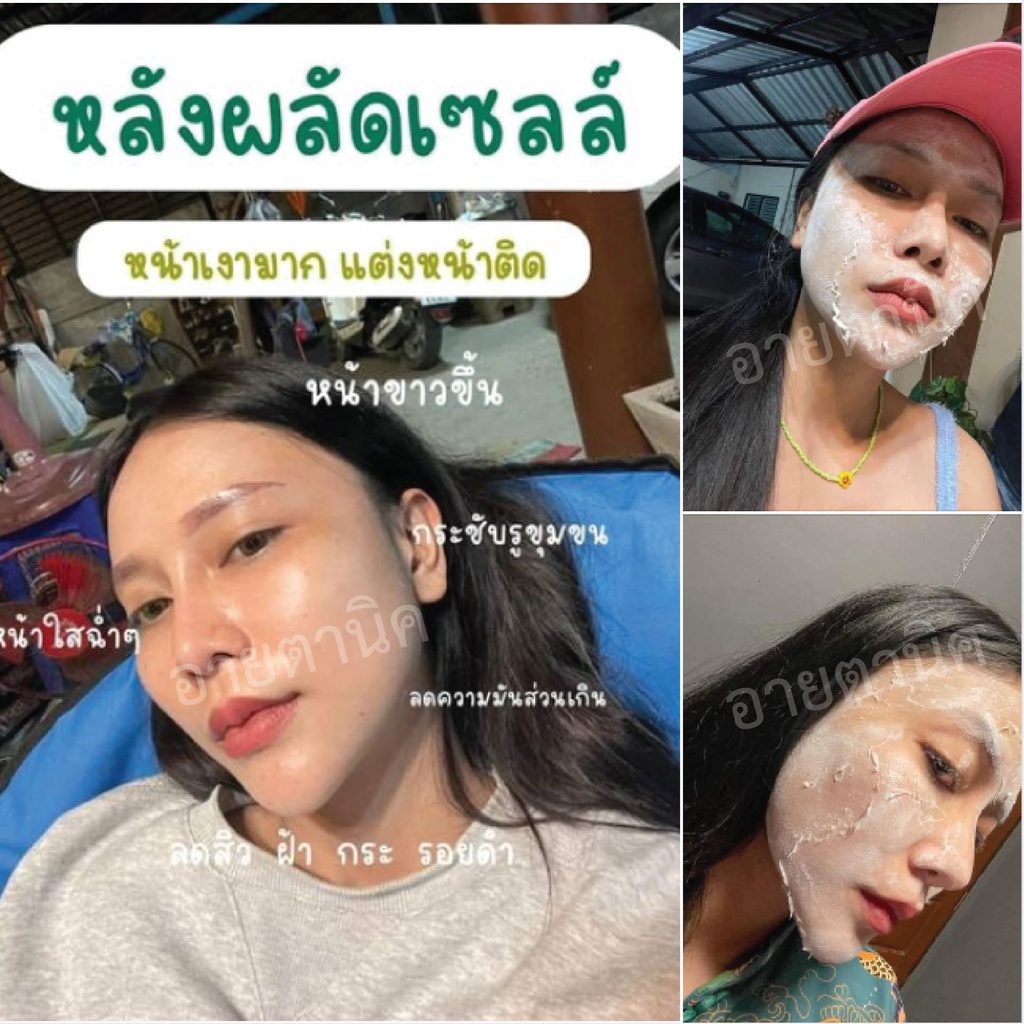 อายตานิค-เซทผลัดเซลล์ผิวหน้า-ลดจุดด่างดำ-ขาวใสเรียบเนียน-รูขุมขนกระชับ