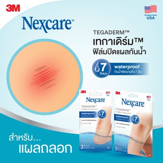 ภาพขนาดย่อของภาพหน้าปกสินค้า3M Nexcare Tegaderm A1 ขนาด 6x7ซม.  เน็กซ์แคร์ เทกาเดิร์ม แผ่นเทปใสปิดแผลกันน้ำ ฟิล์มปิดแผลกันน้ำ จากร้าน medicalsupport บน Shopee