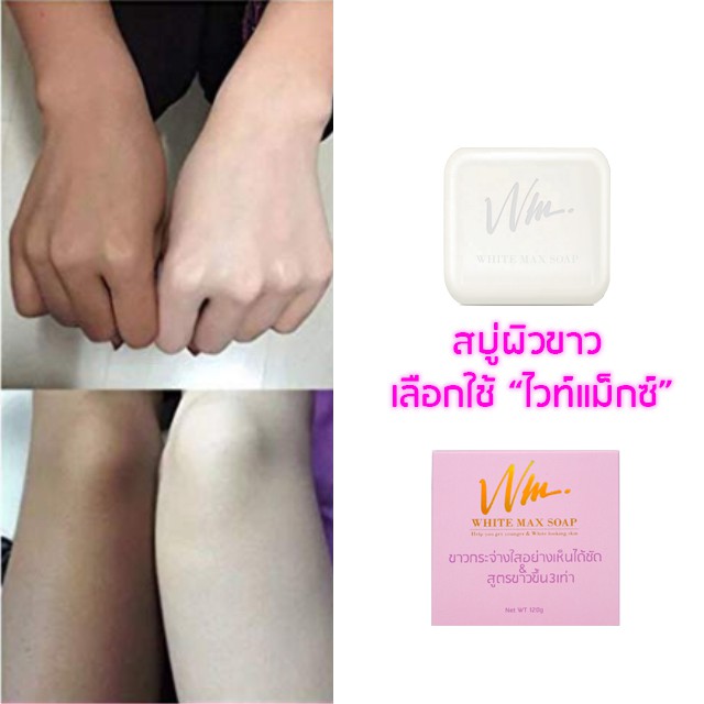 สบู่white-maxกำจัดรอยสิว-ฝ้า-กระ-จุดด่างดำ-หมองคล่ำ-ให้ขาวใสสว่างขึ้นได้ภายใน7วันท้าให้ลอง-มีอย-รับรองจ้า