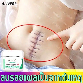 ALIVER ครีมลดรอยแผลเป็น ครีมรักษาแผลเป็น ครีมลบแผลเป็น ครีมรักษาแผลเป็น ครีมลบแผลเป็น แผลไฟไหม้ รอยแตกลาย ซ่อมแซมผิวหนัง