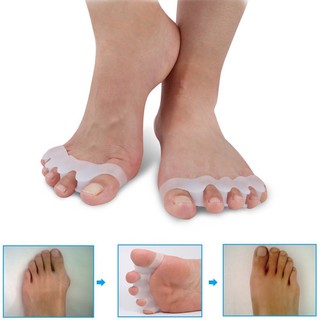 ที่คั่นนิ้วเท้าซิลิโคนเพื่อบรรเทาอาการปวดเท้า เครื่องแยกนิ้วเท้า 5 นิ้ว 2 ชิ้น จัดระเบียบนิ้วเท้า แก้ไขการทับซ้อนกระดูก