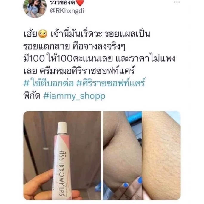 พร้อมส่ง-ศิริราช-ซอฟท์แคร์-ครีมหมอศิริราช-ลดรอยแตกลาย-รอยแผลเป็น-ท้องลาย-ตูดลาย-แผลนูน