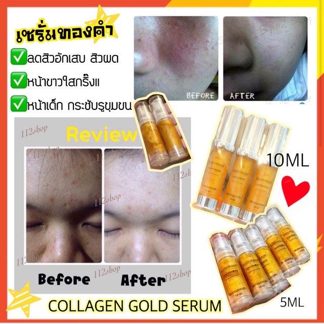 พร้อมส่ง-เซรั่มคอลลาเจนทองคำ-collagen-gold-serum-babyface-หน้าใส-หน้าเด็ก