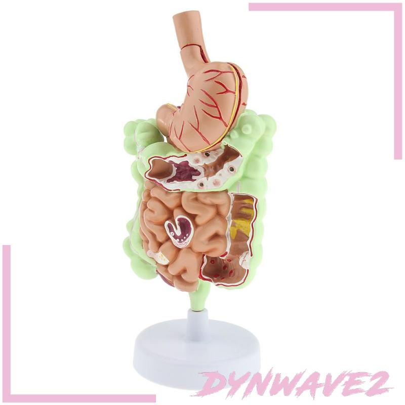 dynwave2-โมเดลกระเพาะอาหาร-ระบบย่อยอาหารมนุษย์