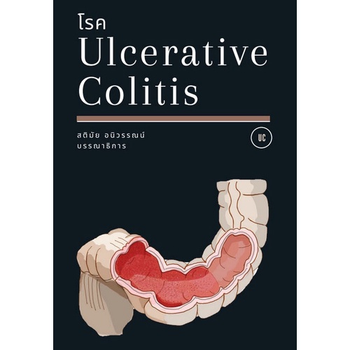 chulabook-c111-9786165867634-หนังสือ-โรค-ulcerative-colitis
