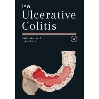 9786165867634|c111|โรค ULCERATIVE COLITIS