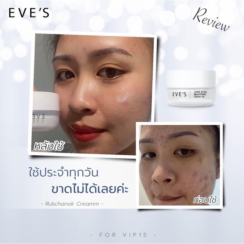 ครีมเจลอีฟ-white-reveal-brightening-creamm-gel-รีวิวจากผู้ใช้จริง-ใช้ดีบอกต่อ-ครีมลบรอยดำ