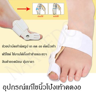 สินค้า เฝือกอ่อน อุปกรณ์แก้ไขเท้าผิดรูป (สำหรับผู้มีนิ้วโป้งเท้าเอียง) คดงอ ดัดเท้า เท้าเก เท้าเอียง ฟรีไซร์ พร้อมส่ง คุ้มราคา