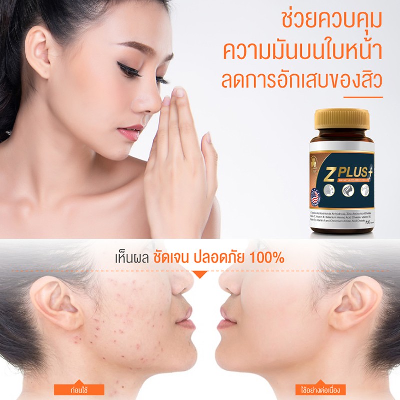 ภาพสินค้าClover Plus Zplus Zinc (30 แคปซูล) ลดสิวอักเสบ รอยสิว ลดความมันบนใบหน้า เสริมภูมิคุ้มกัน บำรุงฟื้นฟูผมและเล็บให้แข็งแรง จากร้าน dees_health บน Shopee ภาพที่ 5