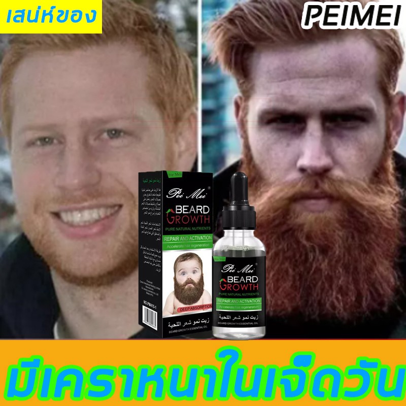 peimei30ml-น้ำยาปลูกหนวด-น้ำยาปลูกเครา-ยาปลูกหนวด-น้ำยาปลูกคิ้ว-ปลูกหนวด-น้ำมันปลูกหนวด-เซรั่มปลูกเครา-น้ำมันหนวด